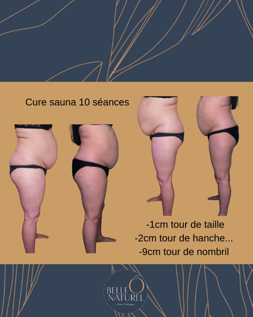 Avant/après d'une cure de 10 séances de sauna japonais